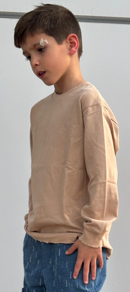 בייסיק קרעים אוברסייז